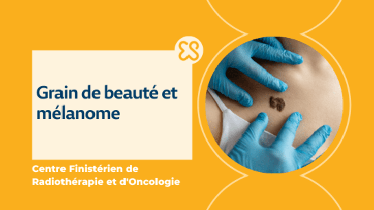 Mélanome, grain de beauté, cancer peau et règle ABCDE